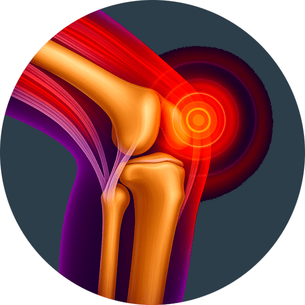 Inflammation articulaire