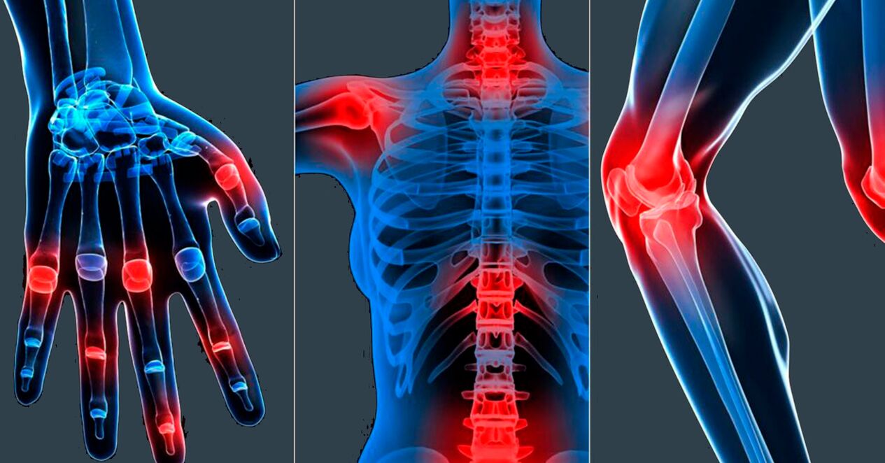 Mode d'emploi de l'extrait de boswellia en gélules